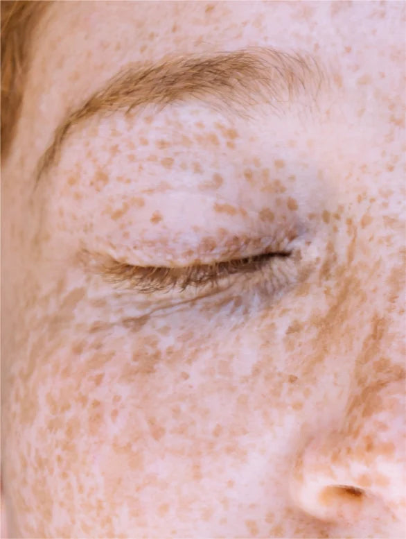 Close-up of woman closed eye with freckles.